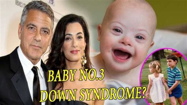Celebrity Child With Down Syndrome: George Clooney's Inspiring Story