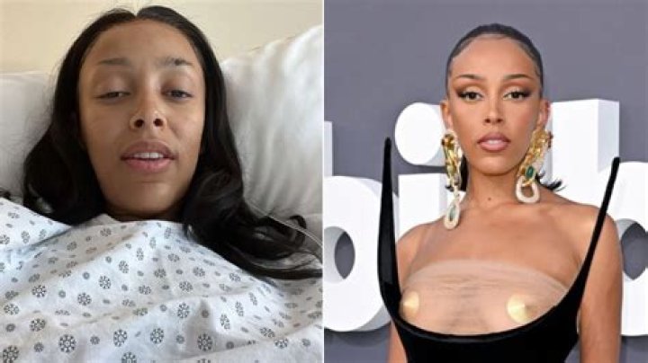 Doja Cat Reveals Surgery Plans: 'I Want My Titties Pulled Up'