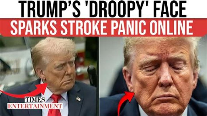 Donald Trump's Face Has Been Found In A Dog's Ear, And Twitter Is Freaking Out