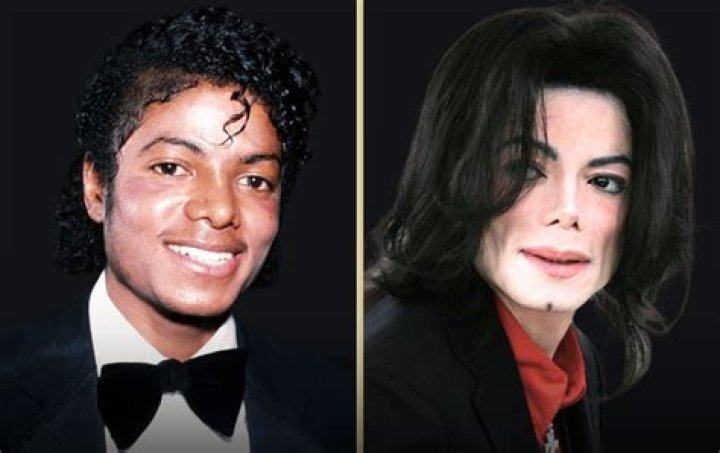Jack White No Makeup Look- Plastic Surgery Before And After