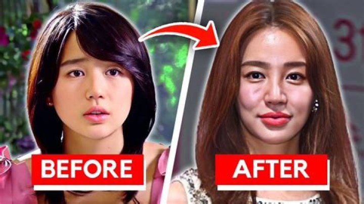Kim Chaewon Plastic Surgery: Before And After Photos