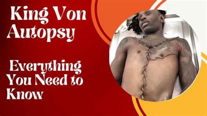KingVon Autopsy Photos Emerge: Gruesome Details Revealed
