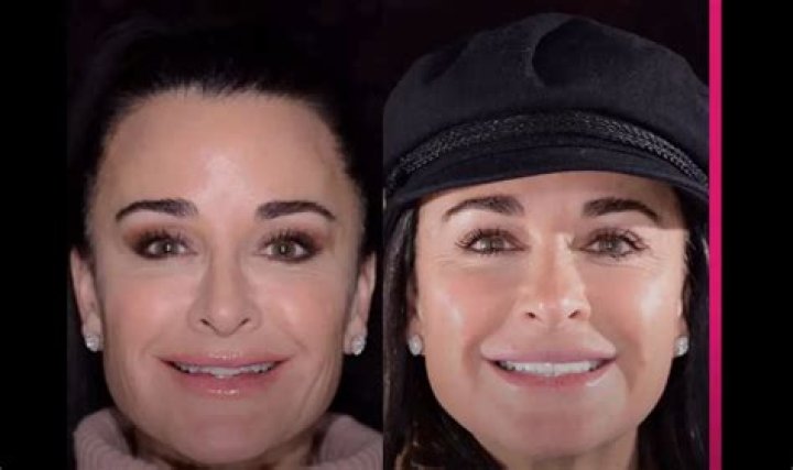 Kyle Richards’ Teeth Makeover Explained by Her Dentist