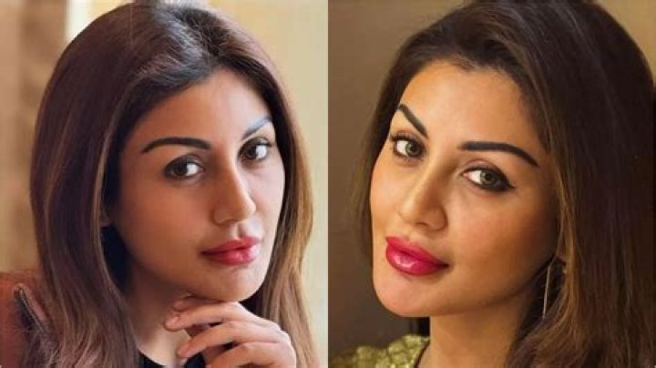 Nikki Tamboli Plastic Surgery Before and After
