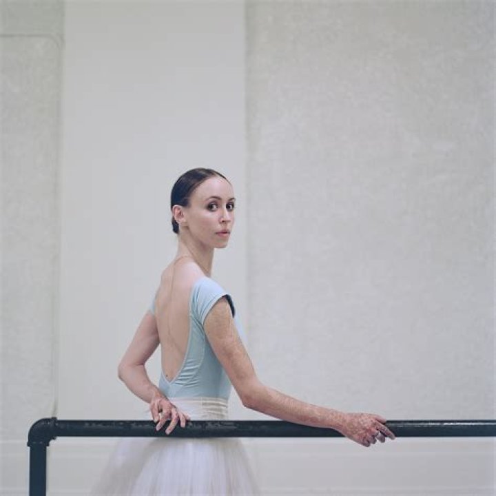 Skylar Brandt – Who is the Husband of Ballet Dancer Skylar Brandt? Age, Bio, Wiki, Career, Net Worth, Dancet, Family & Facts