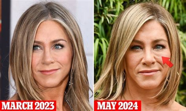 Truth Behind Jennifer Aniston's Face Scar & No-make Up Look