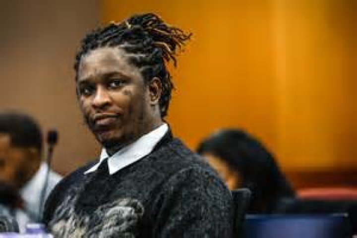 Young Thug Veneers: How Much Did His New Teeth Cost?
