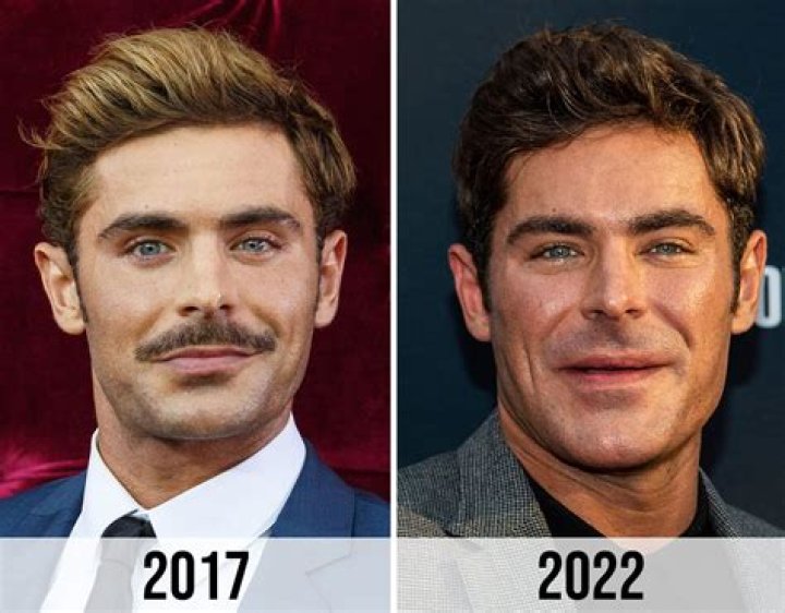 Zac Efron's Jaw and the Terrifying Story Behind What Happened to It